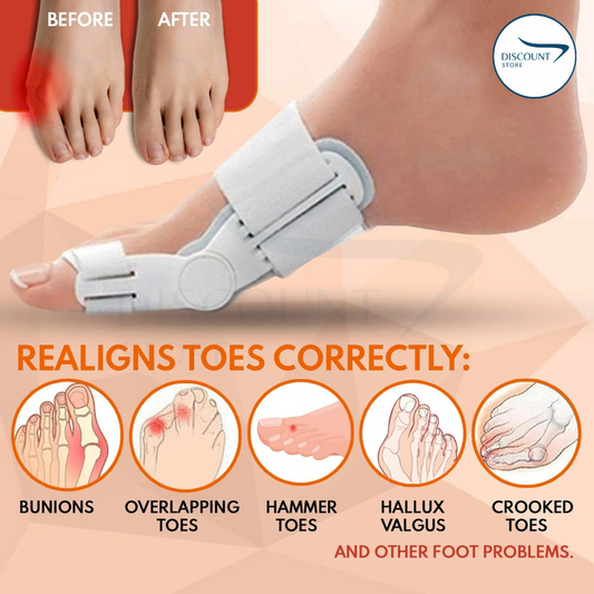 Pain Relief Bunion Toe Corrector - (IMPORTED)